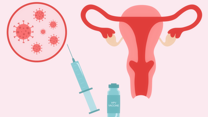 An illustration of a uterus and the HPV vaccine