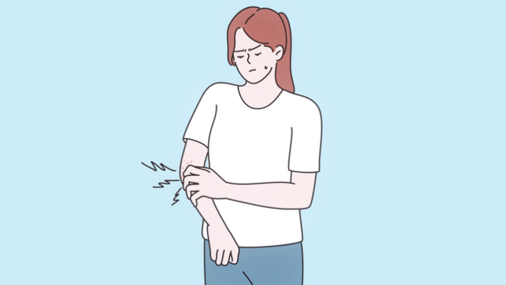An illustration of a woman scratching a rash