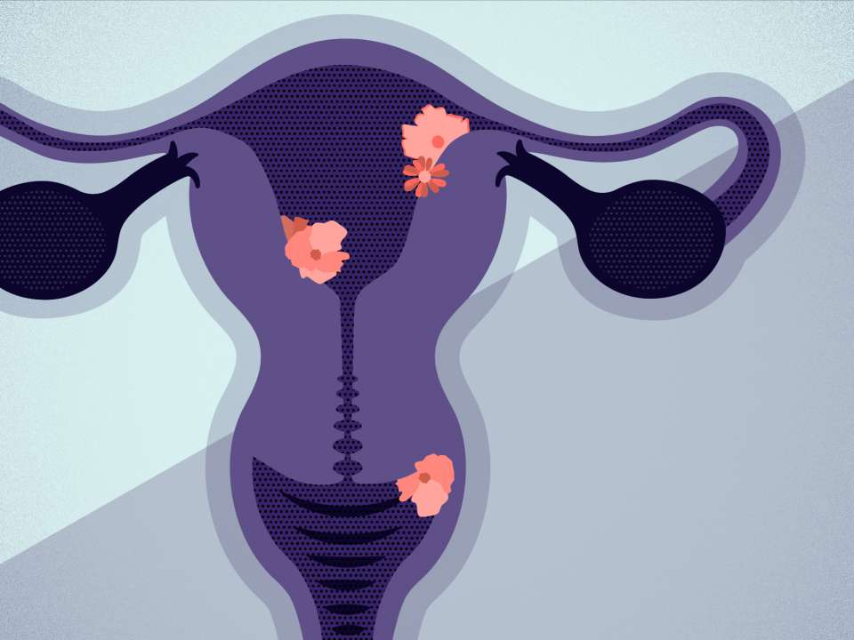An illustration in blues and purples of the vagina and ovaries.