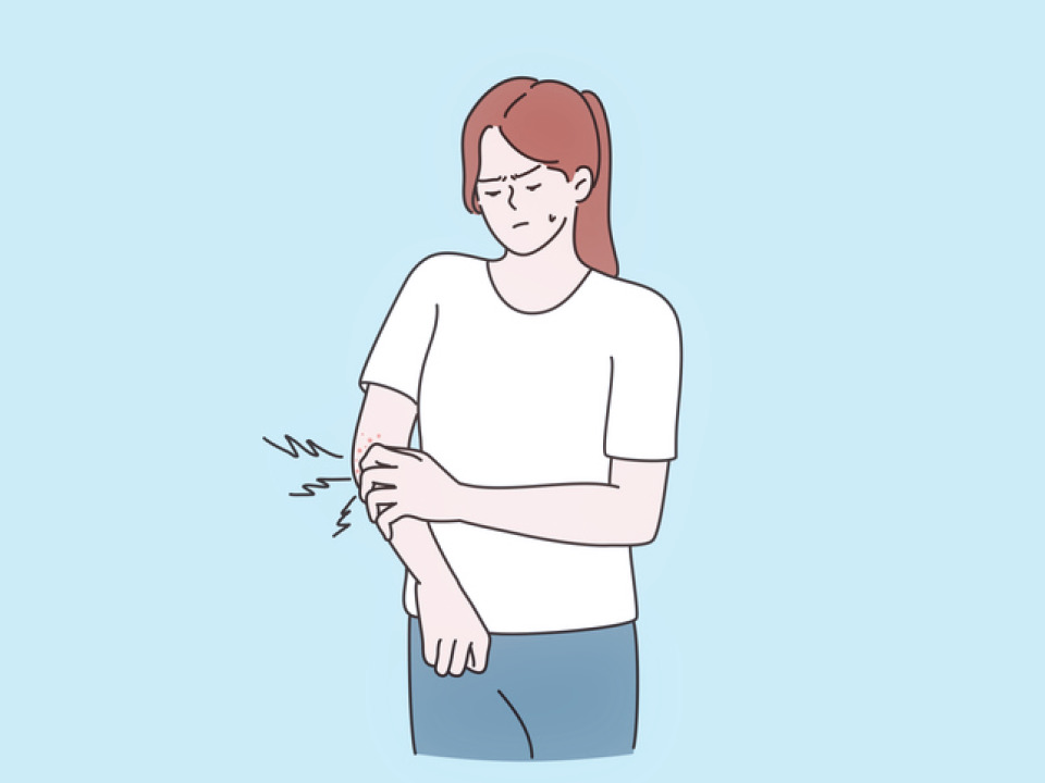 An illustration of a woman scratching a rash